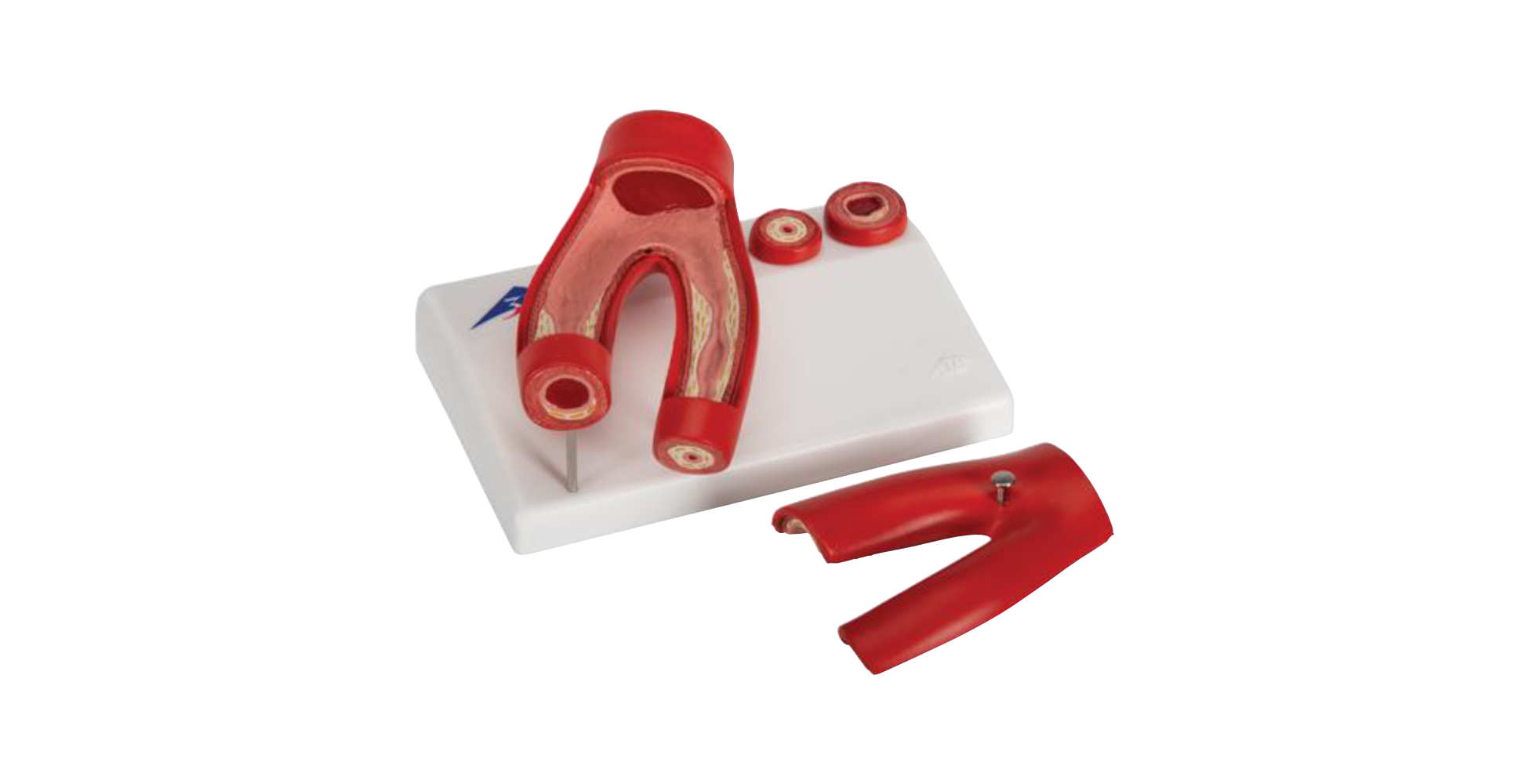 Modelo de arteriosclerosis con sección transversa de la arteria, de 2 piezas dividido