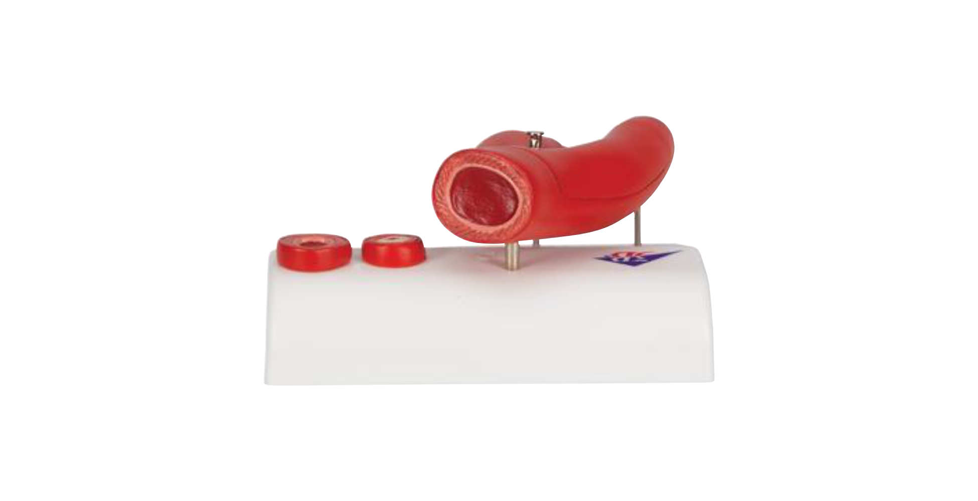 Modelo de arteriosclerosis con sección transversa de la arteria, de 2 piezas vista posterior