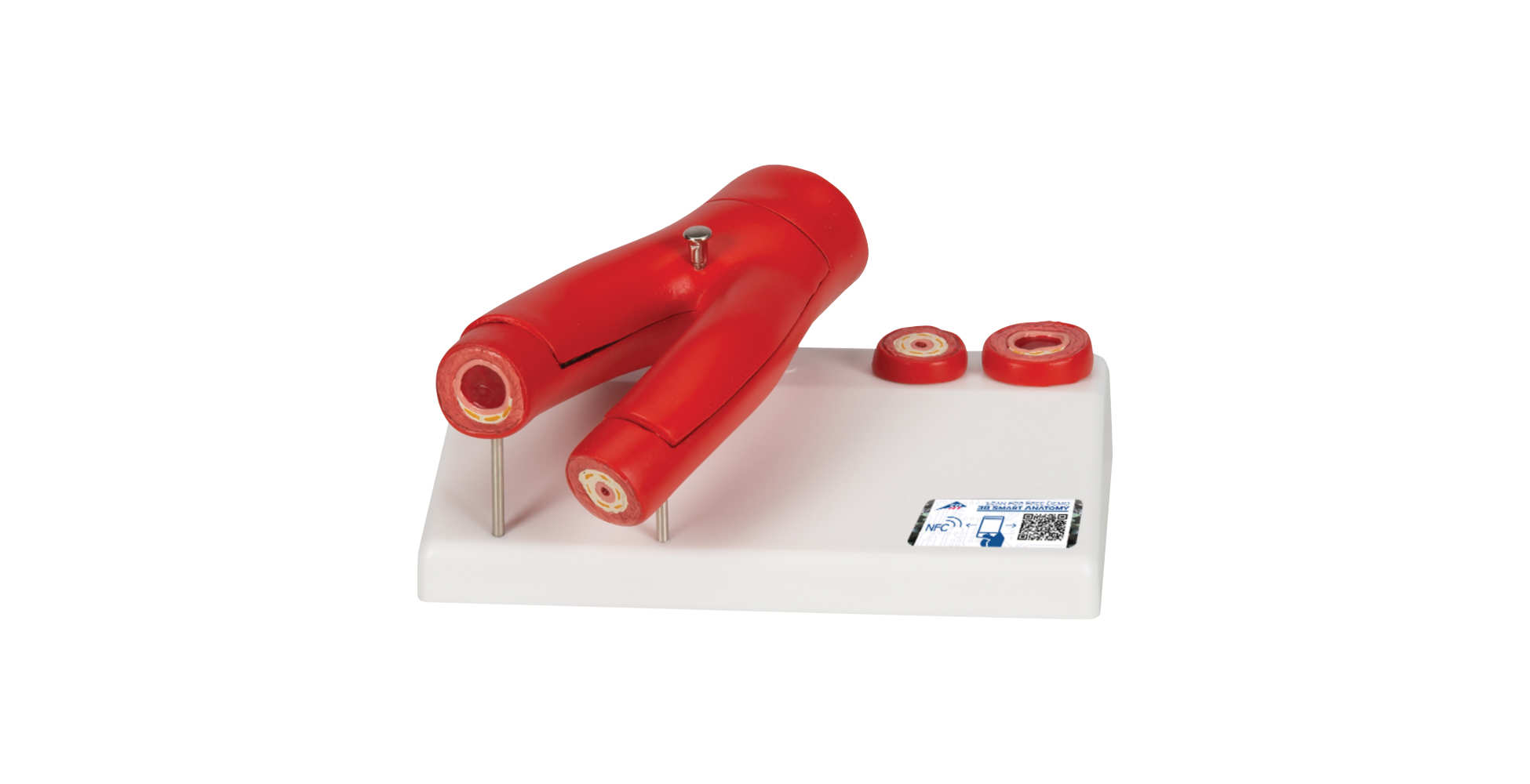 Modelo de arteriosclerosis con sección transversa de la arteria, de 2 piezas