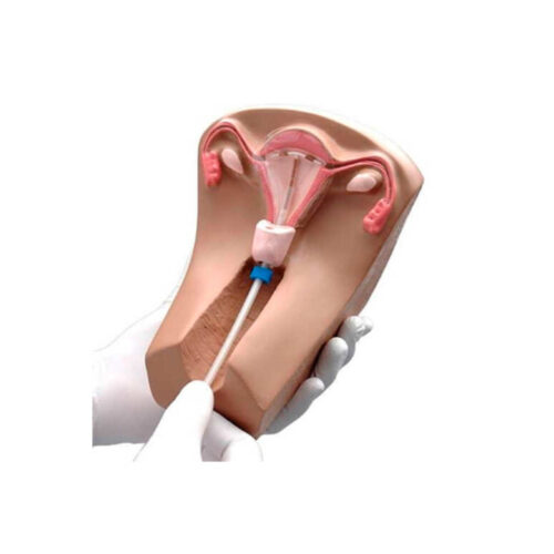 Modelo Inserción de DIU III Tellyes