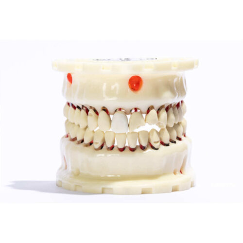 TOM cirugia para endodoncia y exodoncia