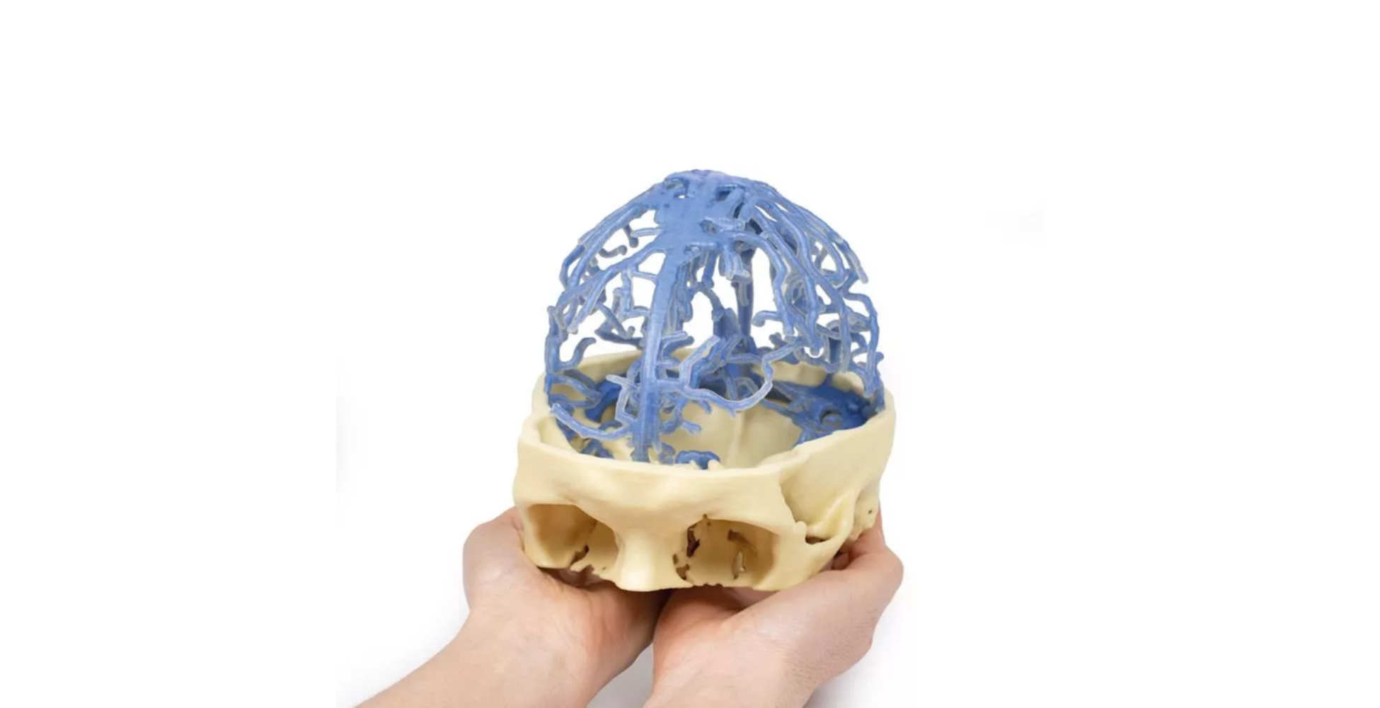 Circulación Venosa Craneal cuatro marcar erler zimmer