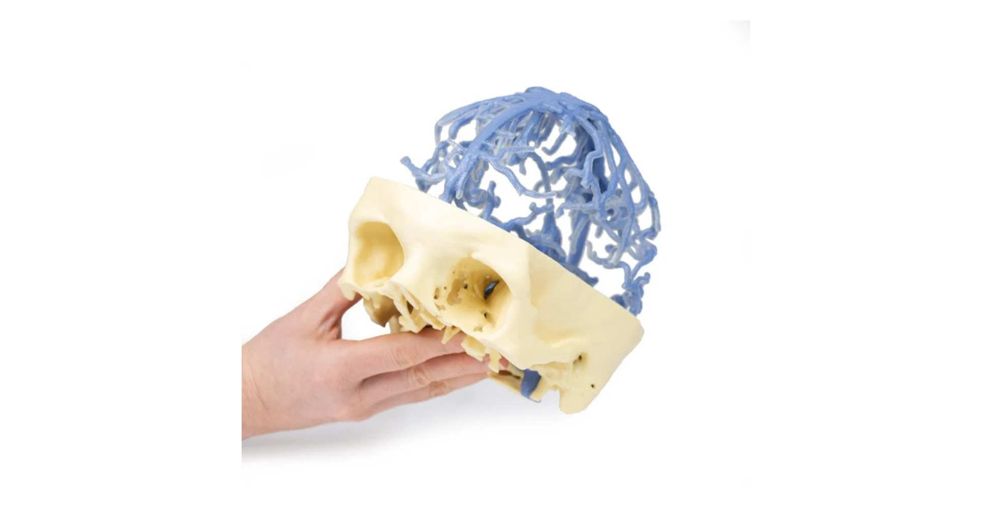 Circulación Venosa Craneal dos marcar erler zimmer