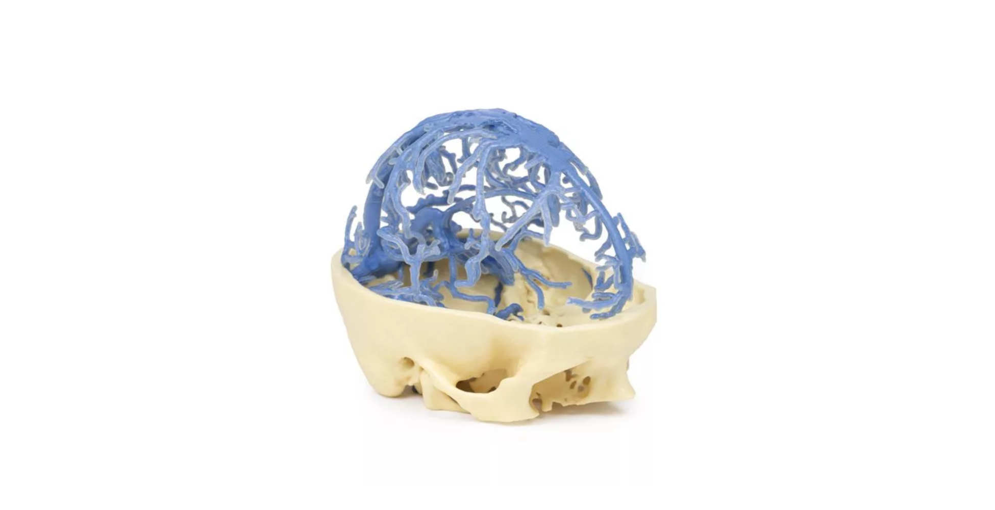 Circulación Venosa Craneal tres marcar erler zimmer