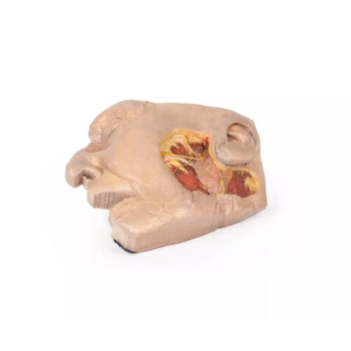 Disección de la Glándula Parótida y el Nervio Facial uno marca erler zimmer