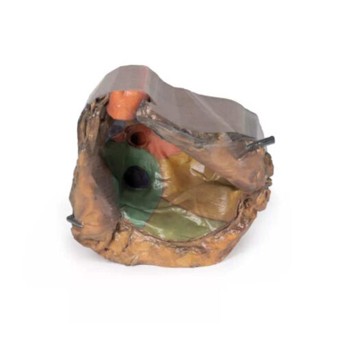 Espacio Pericárdico uno marca erler zimmer