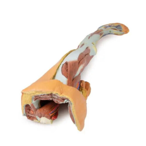 Extremidad inferior disección superficial de pelvis izquierda masculina uno marca erler zimmer