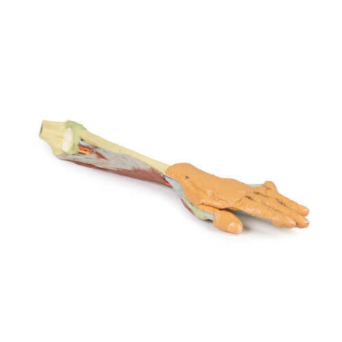 Extremidad superior marca erler zimmer