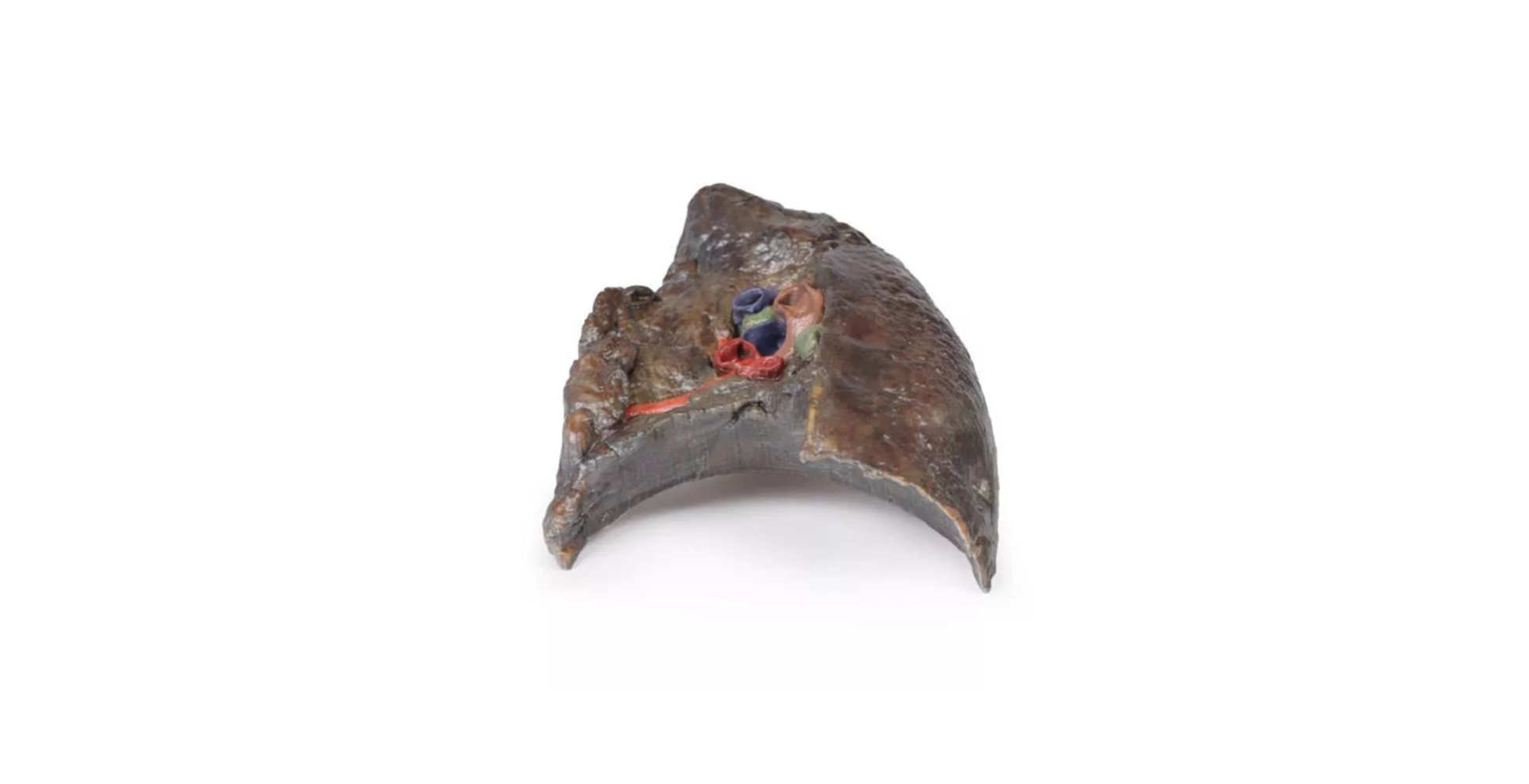 Hilio del Pulmón Derecho uno marca erler zimmer