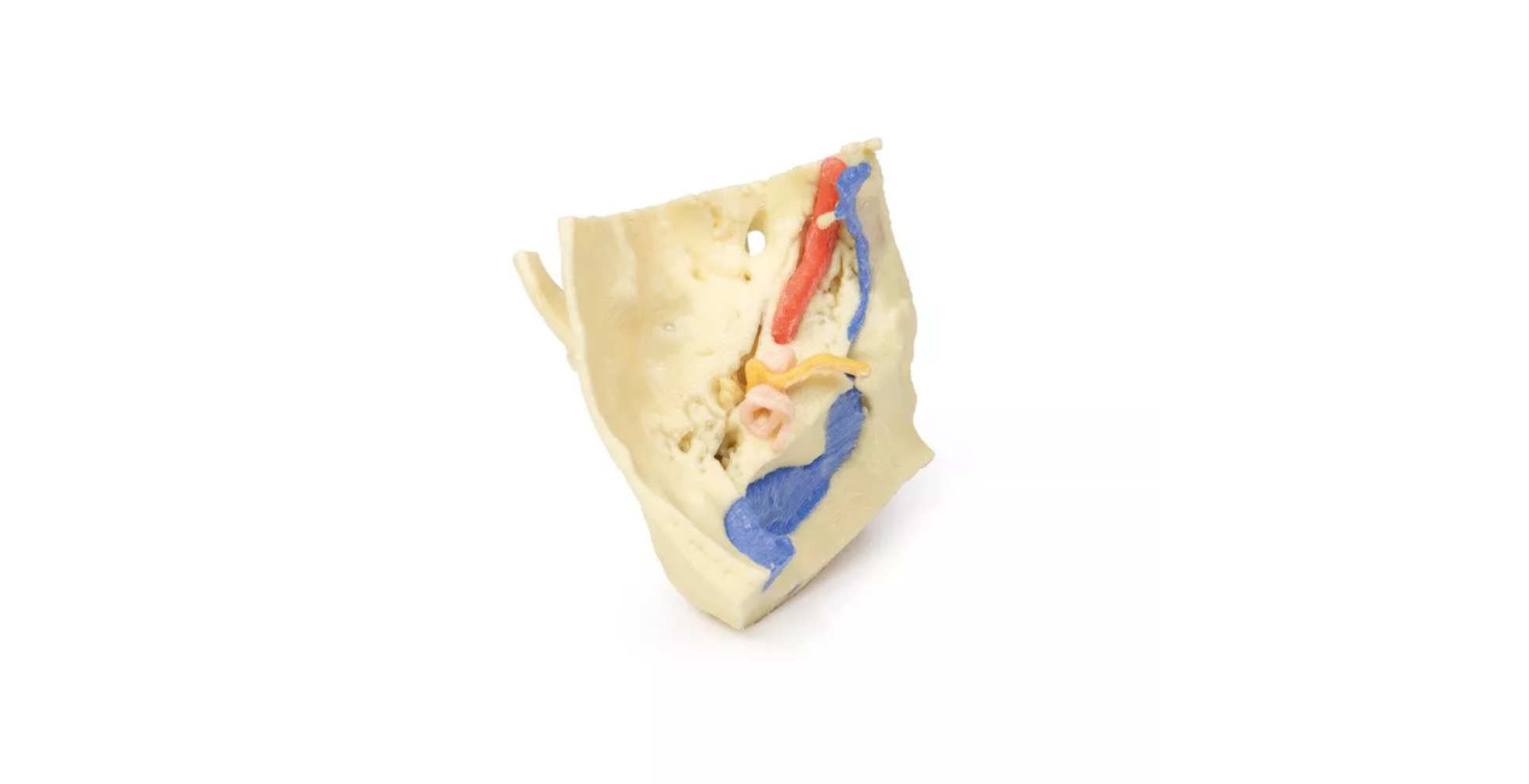 Hueso Temporal Juego de 3 Piezas tres marca erler zimmer