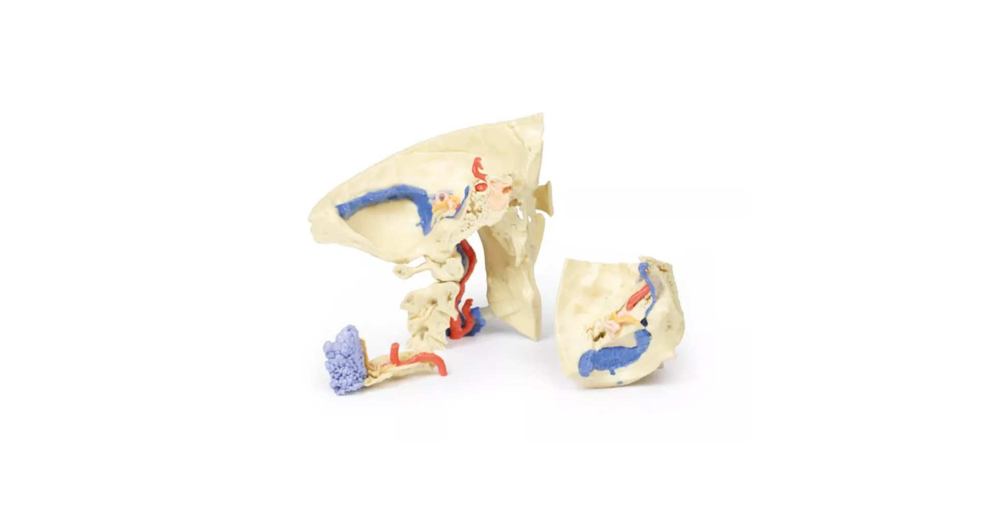 Hueso Temporal Juego de 3 Piezas uno marca erler zimmer