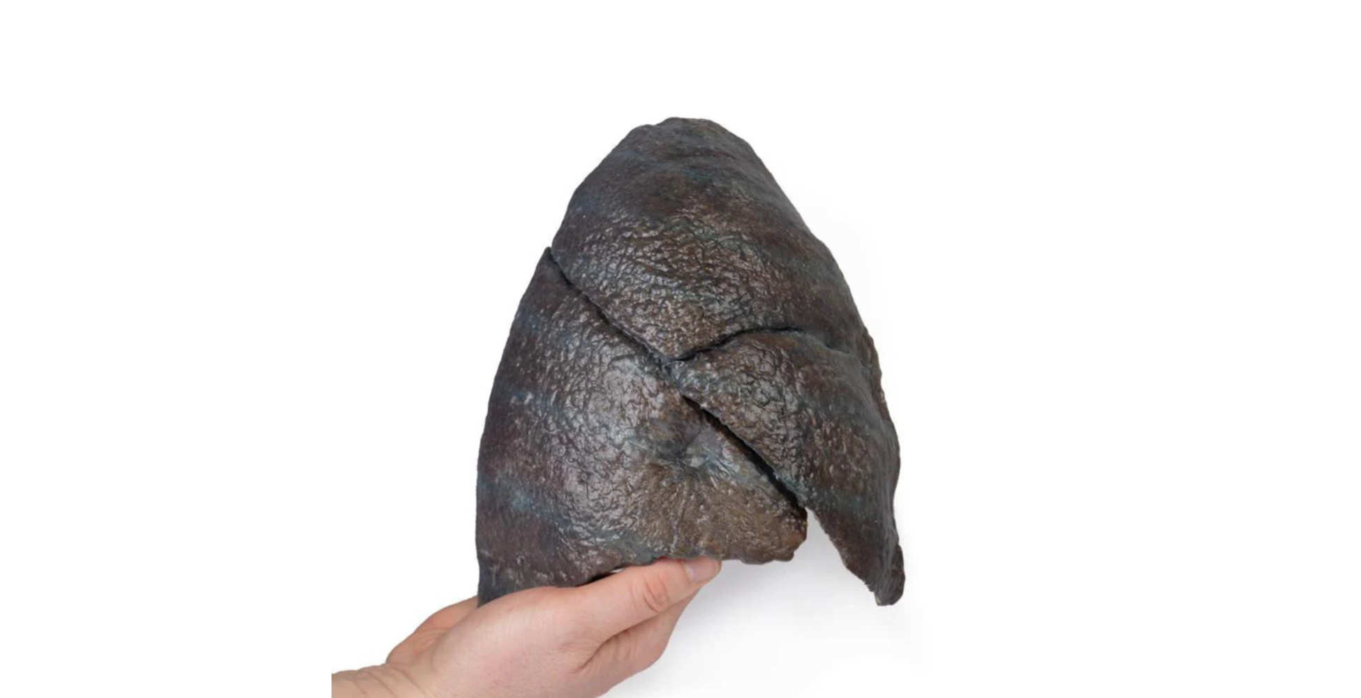 Pulmón Derecho con Hilio Extraído tres marca erler zimmer