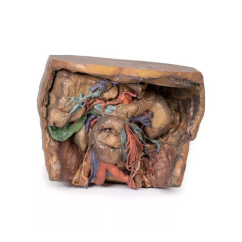 Vasculatura Abdominal uno marca erler zimmer