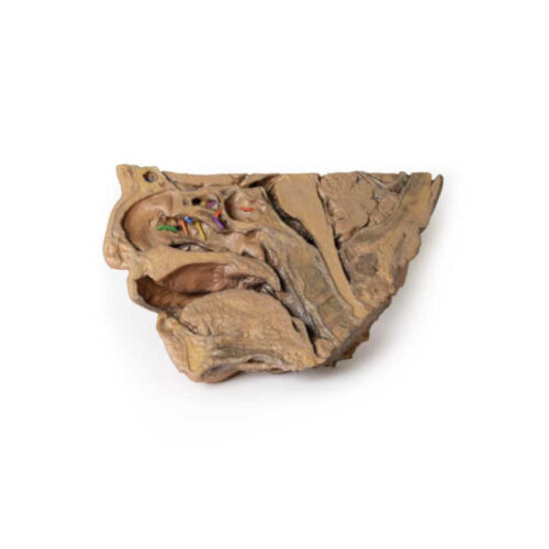 Vías Sinusales uno marca erler zimmer