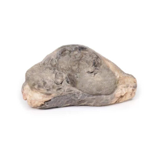 Carcinoma de Mama marca erler zimmer