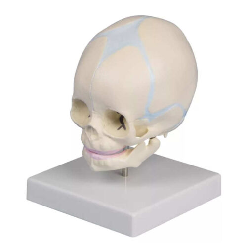 Cráneo de feto de 30 semanas marca erler zimmer