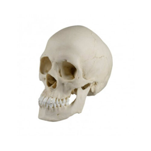 Cráneo escafocefálico marca erler zimmer