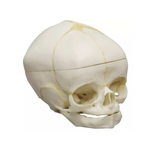 Cráneo fetal humano de 40 semanas con corte en la bóveda craneal