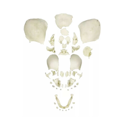 Cráneo fetal humano desarticulado a término marca erler zimmer