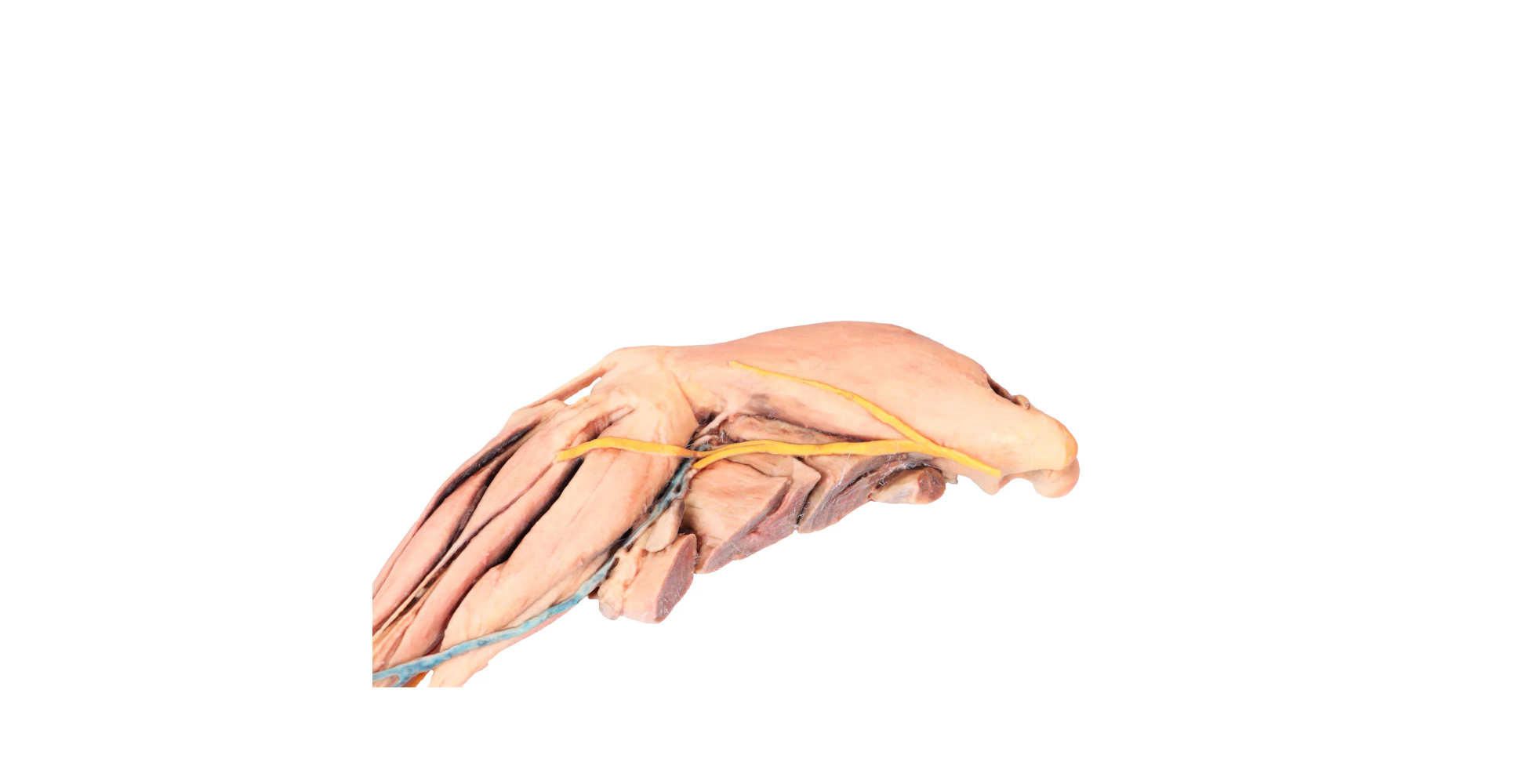 extremidad posterior del perro dos marca erler zimmer