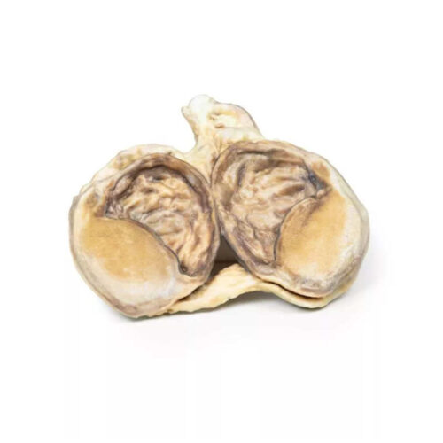 Hidrocele marca erler zimmer