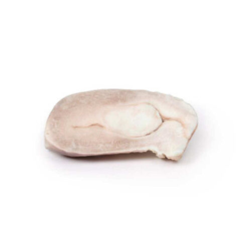 Leiomioma uterino marca erler zimmer