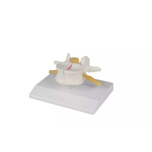 Modelo Anatómico de la vértebra osteoporótica ampliada 2x marca erler zimmer