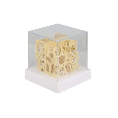 Modelo comparativo de estructura ósea sana y osteoporótica marca erler zimmer