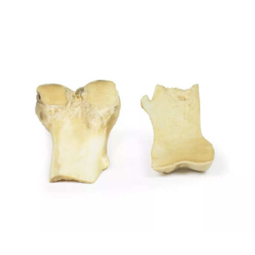 osteocondroma de femur marca erler zimmer