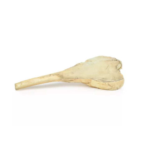 osteosarcoma de femur marca erler zimmer