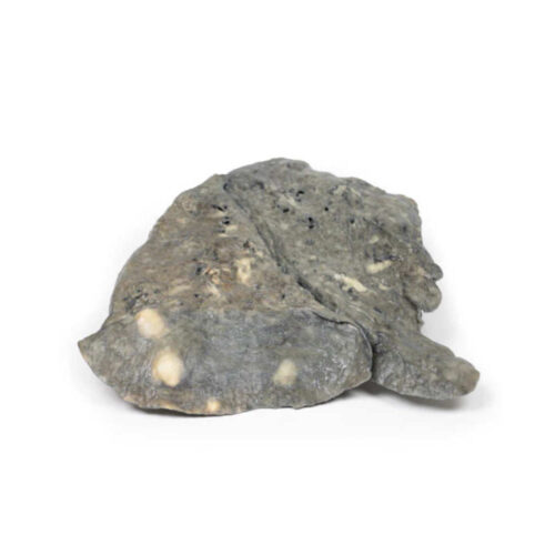 Pulmón con Múltiples Depósitos de Carcinoma Secundario en Pulmón y Pleura uno marca erler zimmer