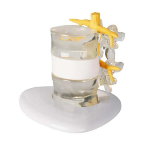 Simulador de hernia discal uno marca erler zimmer