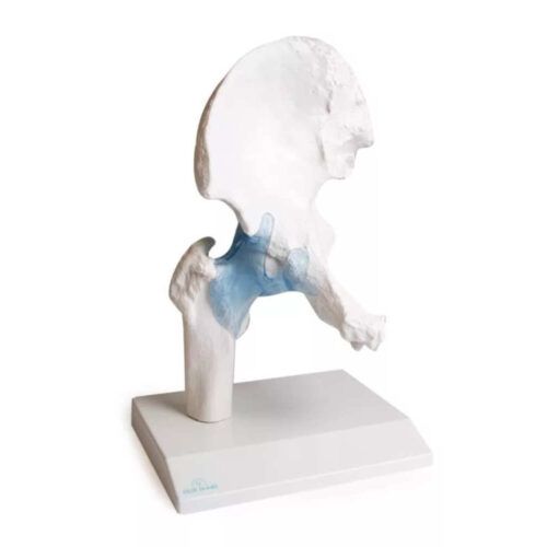 Articulación de cadera con ligamentos y soporte marca erler zimmer