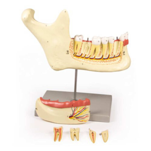Mandíbula inferior, 6 piezas marca erler zimmer