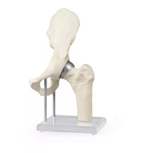 Modelo Anatómico de Articulación de cadera marca erler zimmer