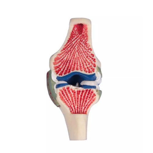Modelo anatómico de rodilla a tamaño real marca erler zimmer