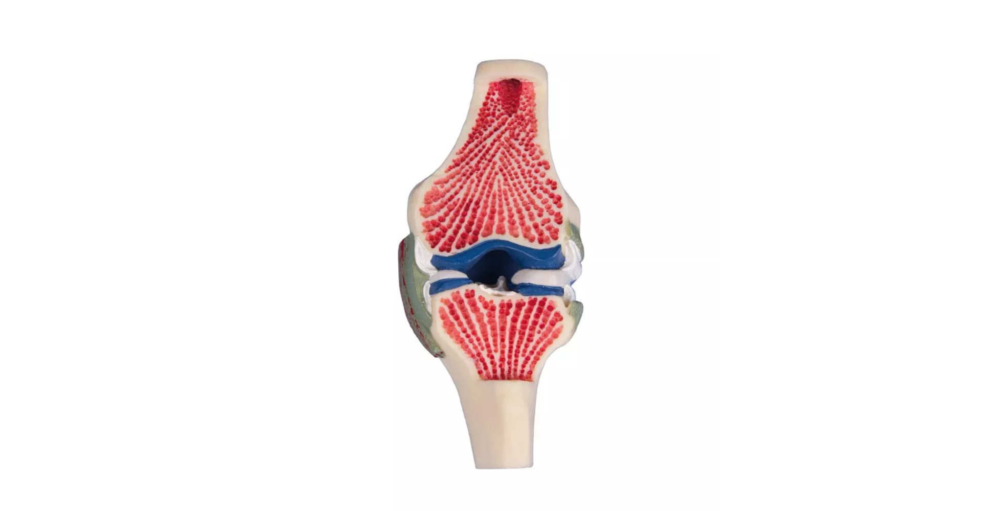 Modelo anatómico de rodilla a tamaño real marca erler zimmer
