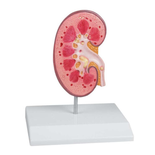Modelo de cálculo renal marca erler zimmer