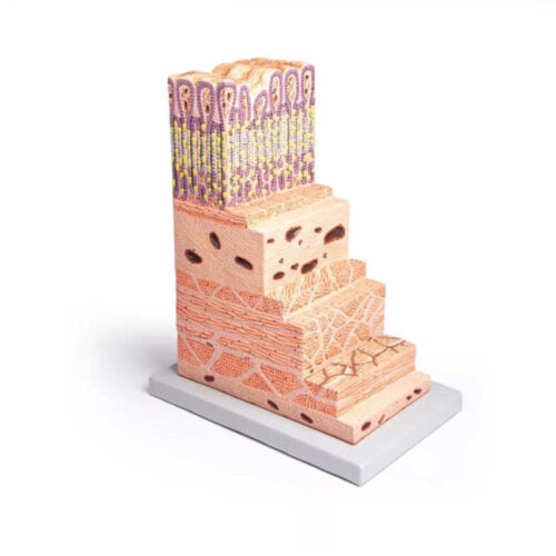 Pared del estómago marca erler zimmer