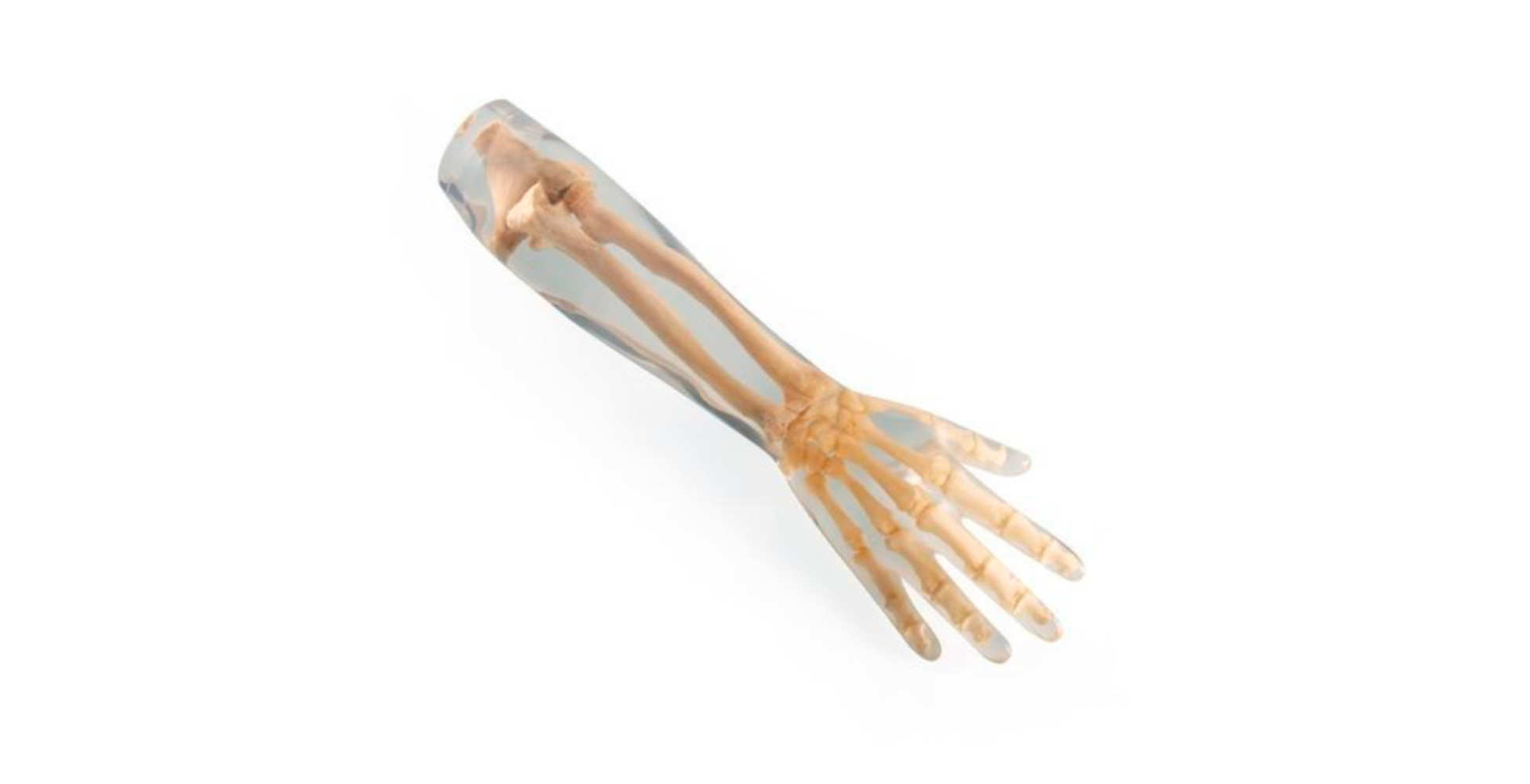 Fantoma de rayos X para brazo inferior marca erler zimmer