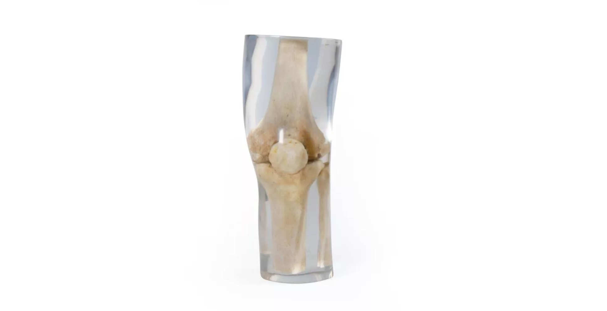 Fantoma de rodilla para rayos X marca erler zimmer