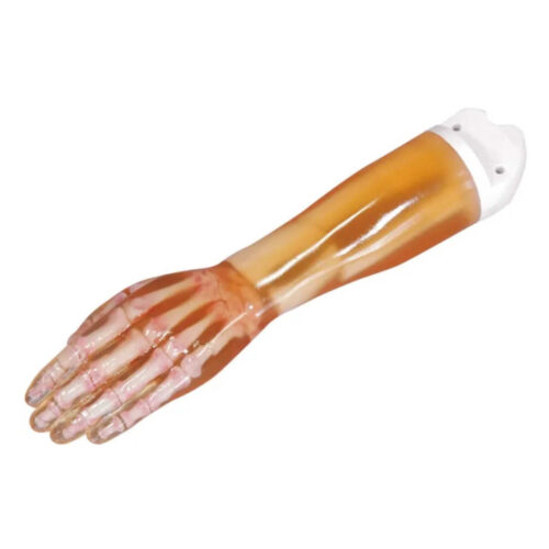 Mano fracturada con antebrazo para diagnóstico y entrenamiento en rayos X marca erler zimmer