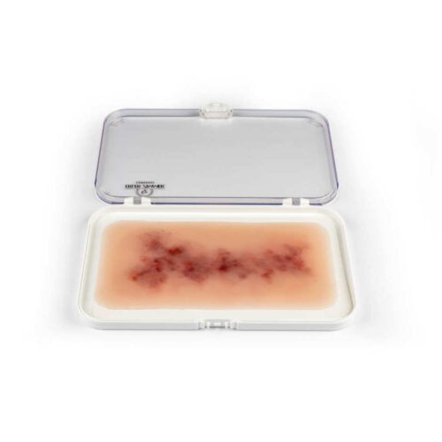 Simulador de hematoma antiguo uno