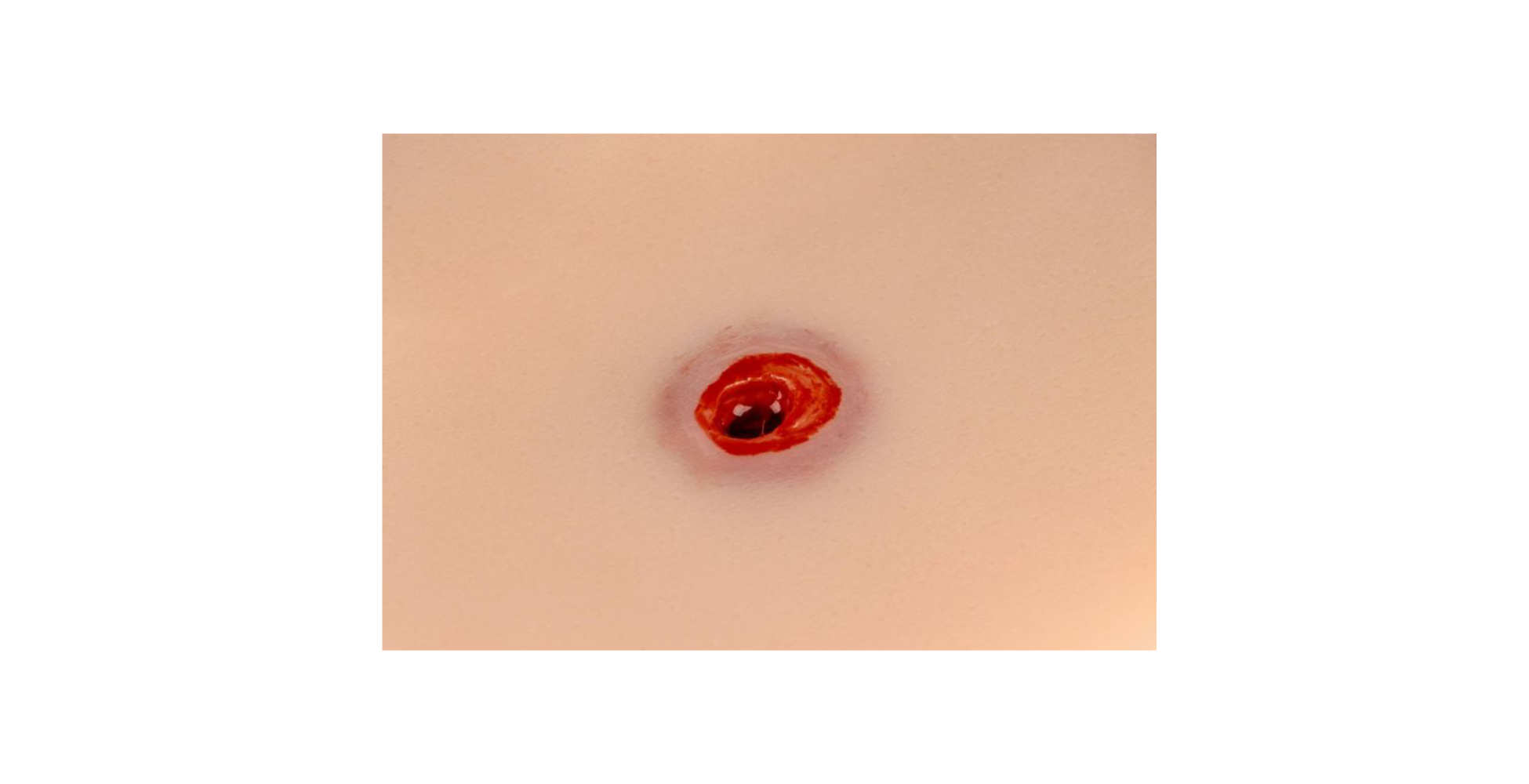 Simulador de herida de bala en el brazo seis marca erler zimmer